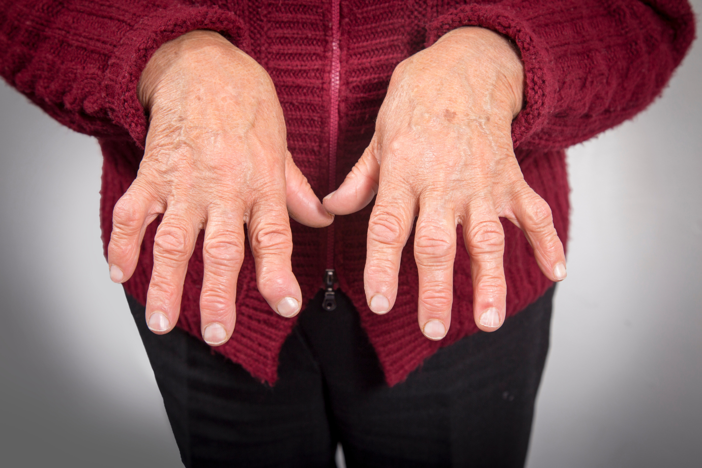 Apa Itu Rheumatoid Arthritis? – Rs. Mitra Medika Premiere - Rs Mitra 