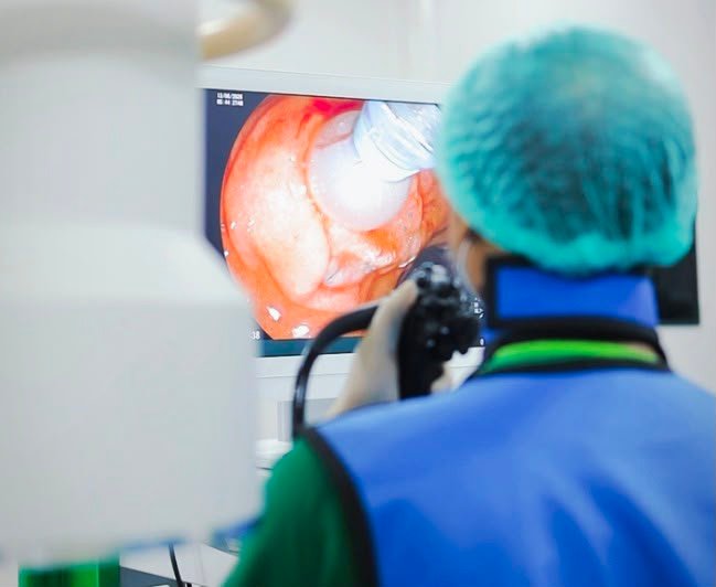 eRCP : teknologi pemeriksaan dan terapi untuk masalah empedu dan pankreas tanpa operasi